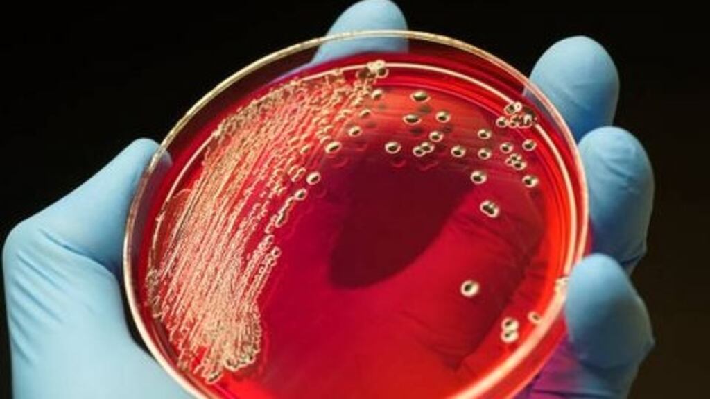 Sepsis is a life-threatening condition triggered when infection in the blood stream overwhelms the body’s immune system. Photograph: ,Getty Images