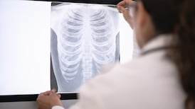Lung cancer: Under half of patients seen on time in major hospital