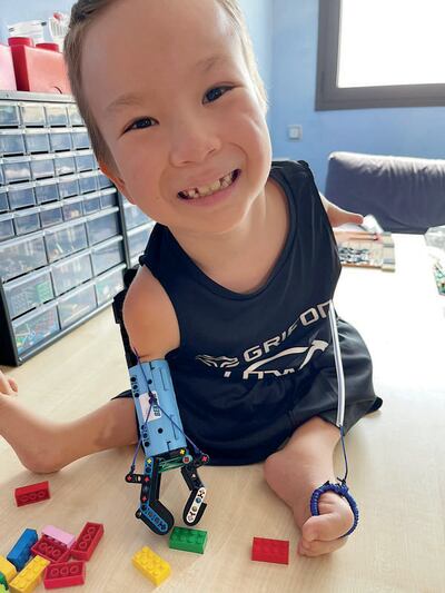Beknur Zhanibekuly wearing one of the Lego prostheses that David Aguilar built for him