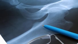 New hip replacement therapy halves hospital time, says surgeon