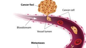 Breast cancer finding: Cell discovery could improve treatment