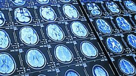 Animated videos  devised to help keep brain young