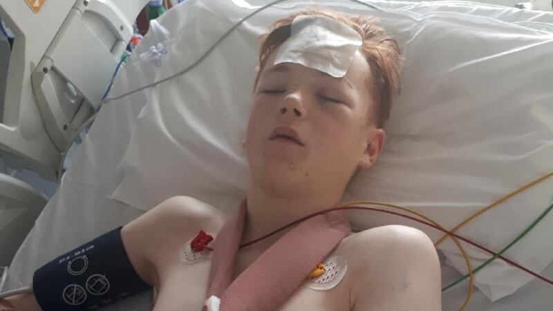Sean O’Reilly (14) who was seriously injured by a hit and run driver in Dublin is recovering at Crumlin Children’s Hospital. Photograph: John O’Reilly