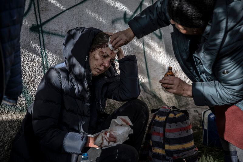 An injured woman receives treatment following Monday's missile attack by Russia on Kyiv. Photograph: Finbarr O'Reilly/The New York Times