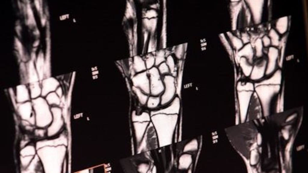 The Health Service Executive, which is expected to overspend by at least €350 million this year, has severely cut back on staff recruitment this year in order to reduce costs. Three staff must leave before one new member can be recruited. File photograph: Getty Images