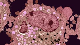 Irish researchers make stem-cell cancer breakthrough