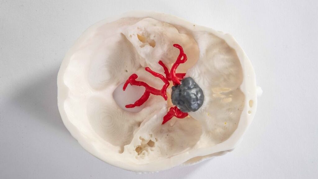 The company prints precise anatomical models using data generated from CT, MRI and PET scans.