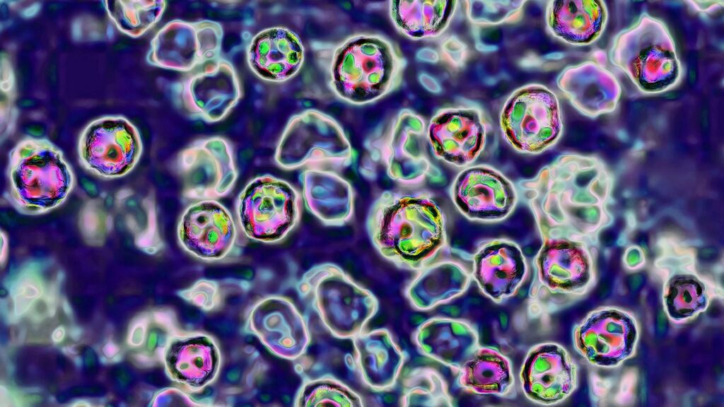 The measles virus: More than 65 cases of measles have now been reported to the HSE this year. There were three deaths from the disease in 2000 after an outbreak in Dublin. Photograph: BSIP/UIG/Getty