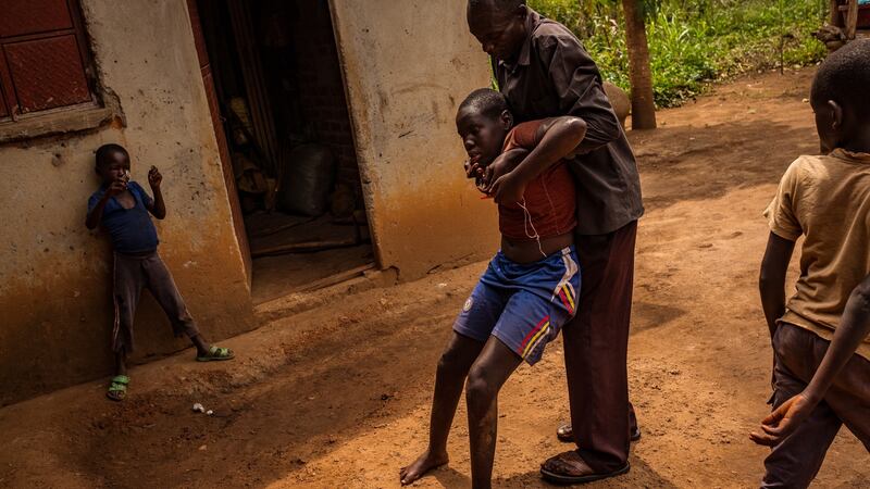 George Abaa carries his 11-year-old daughter Naomi Ecuto into the shade where she can sit in an upright position in Anai Agali, Lira District. Photograph: Christopher Hopkins