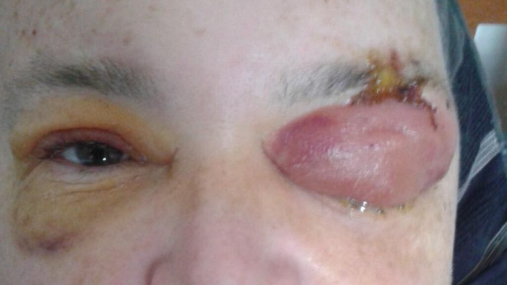 Line of duty: Sgt Dave Haughney lost more than three-quarters of the vision in his left eye after he was attacked