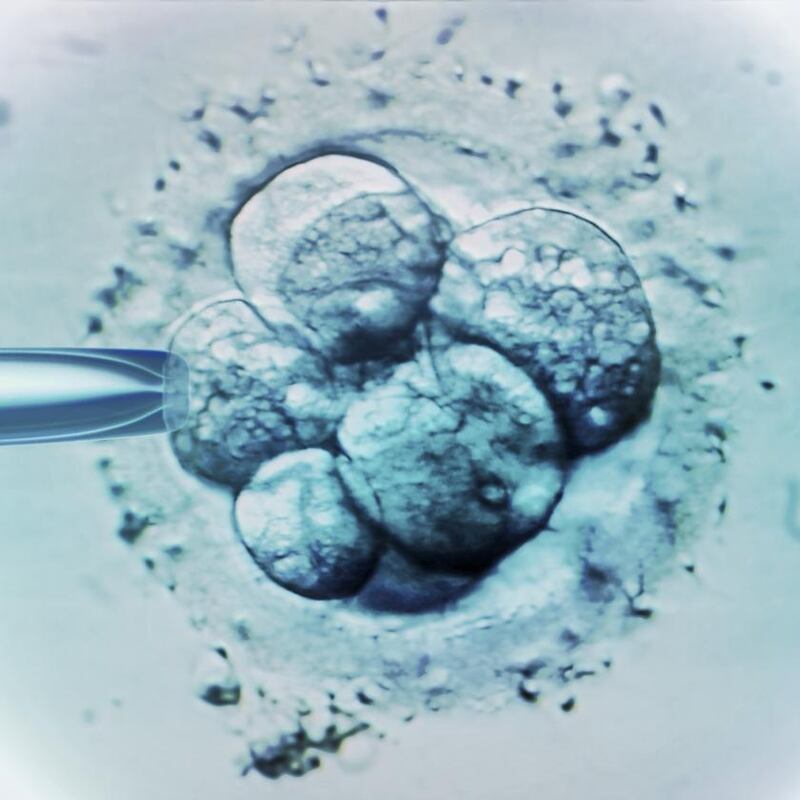 In 2019, then minister for health Simon Harris said he expected publicly funded IVF to be available in 2021. It still hasn’t happened. Photograph: Getty