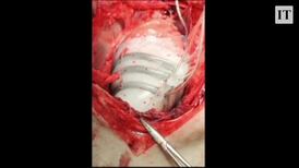 The soft robot that helps your heart beat