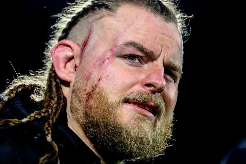 Connacht's Finlay Bealham bears the mark of Josh Caulfield’s boot following the incident that led to the Bristol player being red-carded. Photograph: Bryan Keane/Inpho 