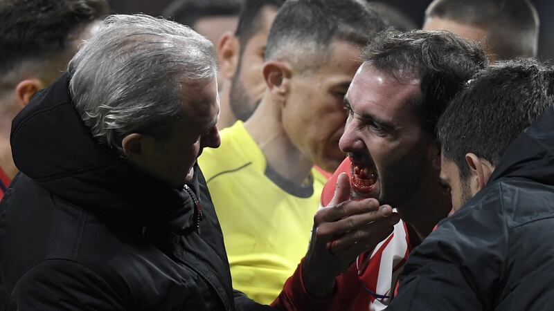 Uruguay defender Diego Godin required surgery after being elbowed in the mouth playing for Atletico Madrid earlier this year. Photograph:   Gabriel Bouys/AFP/Getty Images)