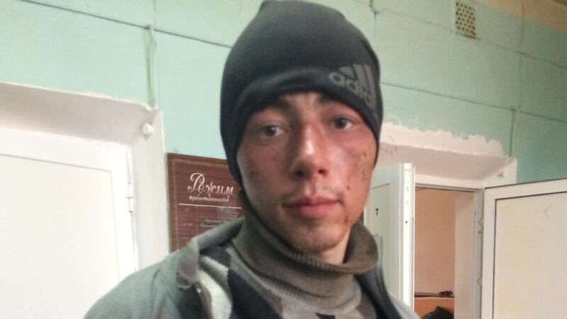 Volunteer Ukrainian fighter Yura Gorbachev (24) in Artemivsk hospital, having walked from for eight hours from Debaltseve after his unit’s trucks were blown up. Photograph: Daniel McLaughlin