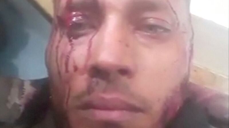 An image of an injured Óscar Pérez from a video that appeared on social media on Monday. Photograph: Social Media Website via Reuters