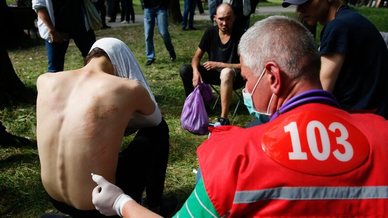 Doctors provide medical treatment to people who were reportedly tortured and beaten by the police, in Minsk on Friday. Photograph: Tatyana Zenkovich/EPA