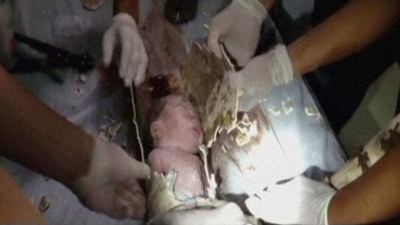 Firefighters and doctors rescue an abandoned newborn baby boy by cutting away a sewage pipe piece by piece, in this still image taken from video, in Jinhua city, Zhejiang province. Photograph:  China Central Television via REUTERS.
