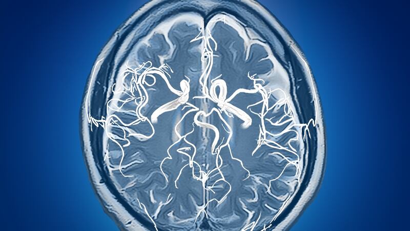 The human brain: “Self-help books started invoking neuroplasticity and saying, ‘Look! You can do anything you like with your brain’. It started grating on me. Can it really be that easy?”