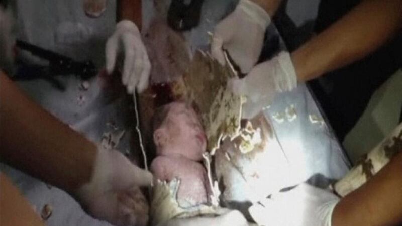 Firefighters and doctors rescue an abandoned newborn baby boy by cutting away a sewage pipe piece by piece, in this still image taken from video, in Jinhua city, Zhejiang province. Photograph: China Central Television/Reuters