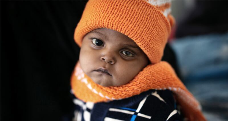Mazen is from Haradh district. His declining health and the lack of nutrition also led to a skin disease and damage to his eye. He is responding well to the treatments and he will soon have surgery to help save his eye. Photograph: Unicef/Yemen/2020/Alghabri