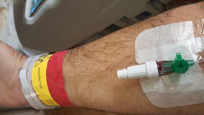 Gerry's arm following the brachytherapy procedure.