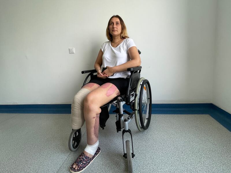 Oksana Hryn (31) in hospital in Lviv, western Ukraine, waiting for a prosthesis after her legs were badly wounded when a Russian mortar shell exploded in her garden in the frontline southeastern city of Hulyaipole.  Photograph: Daniel McLaughlin