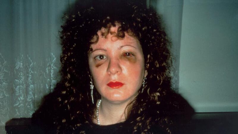 Nan One Month After Being Battered (1984) by Nan Goldin. Copyright Nan Goldin, courtesy Matthew Marks Gallery