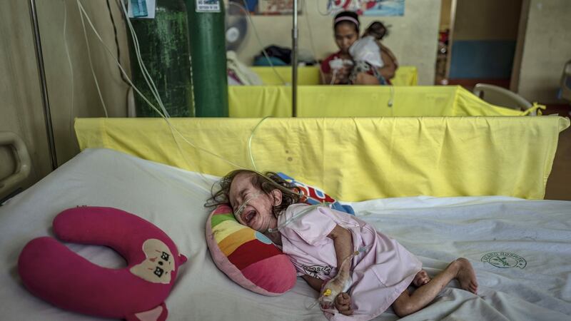 A Filipino child suffering from measles is treated at a government-run hospital in Manila, Philippines. Photograph:  Ezra Acayan/Getty