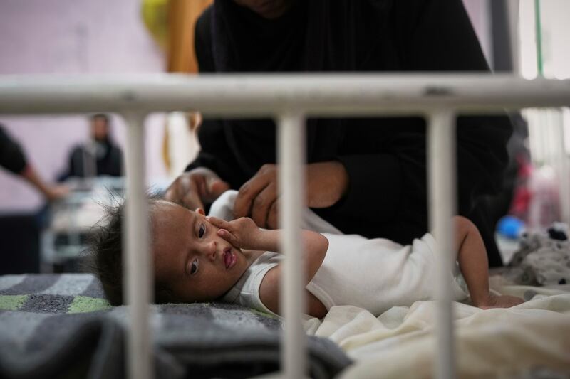 Rahma al-Qadi takes care for her seven-month-old daughter Sama, who was born with Down syndrome and suffers from malnutrition. Photograph: Abdel Kareem Hana/AP