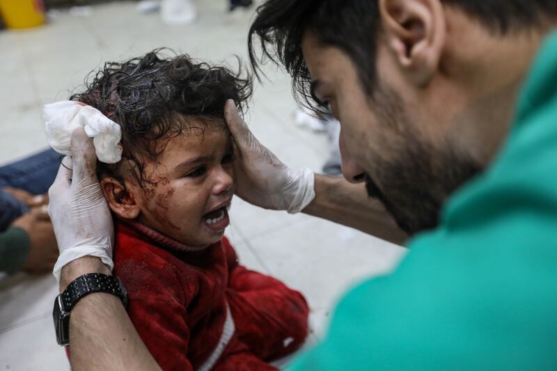 A Palestinian child injured in Israeli air strikes is treated at  Nasser hospital on Tuesday in Khan Yunis, Gaza. Photograph:  Ahmad Hasaballah/Getty Images