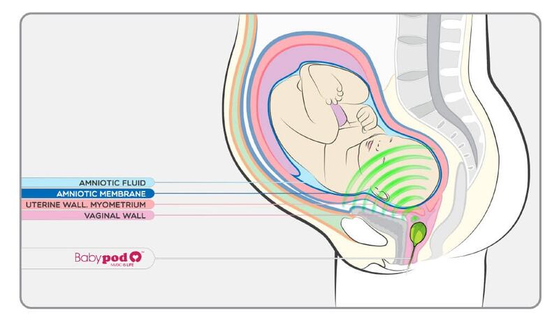 According to Babypod, foetuses can hear external noise clearly only through the vagina, because the abdominal wall muffles sounds. Photograph: Babypod website