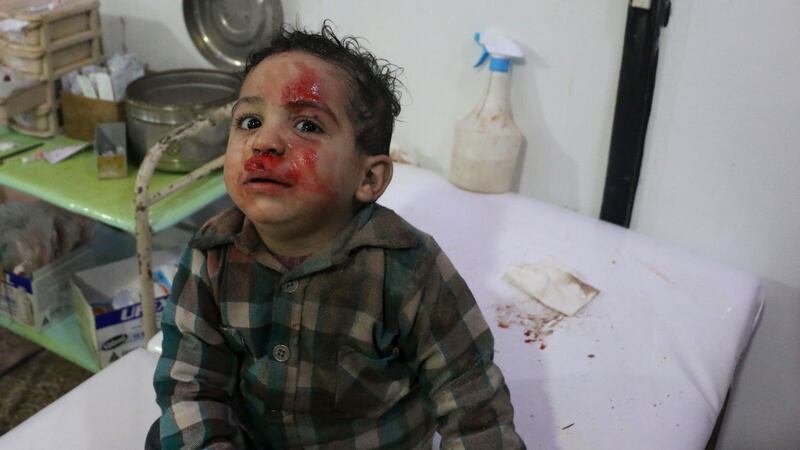 A wounded Syrian boy sits at a makeshift clinic following Syrian government bombardments in Douma, in the besieged eastern Ghouta region, on Thursday. Photograph: Hamza al-Ajweh/AFP/Getty Images
