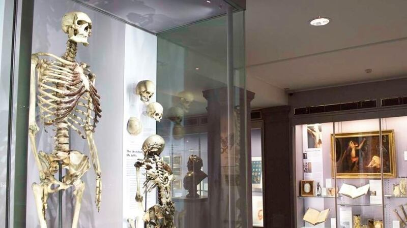 Charles Byrne’s remains in the Hunterian Museum Royal College of Surgeons (2) courtesy of the Board of Trustees of the Hunterian Collection