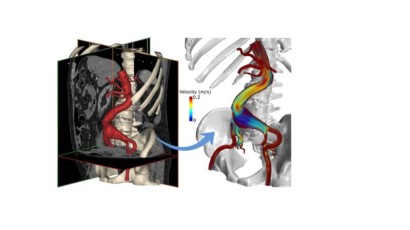 ‘We are using 3D bioprinting to try and print living tissue’