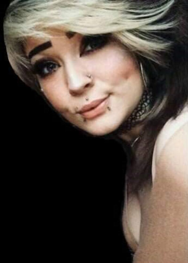 It is claimed that Eve Cleary (21), from Corbally, Co Limerick, was allegedly allowed to develop a deep vein thrombosis, a blood clot in her vein, and that an opportunity had been missed at the hospital to put her on the anticoagulant Heparin on admission 