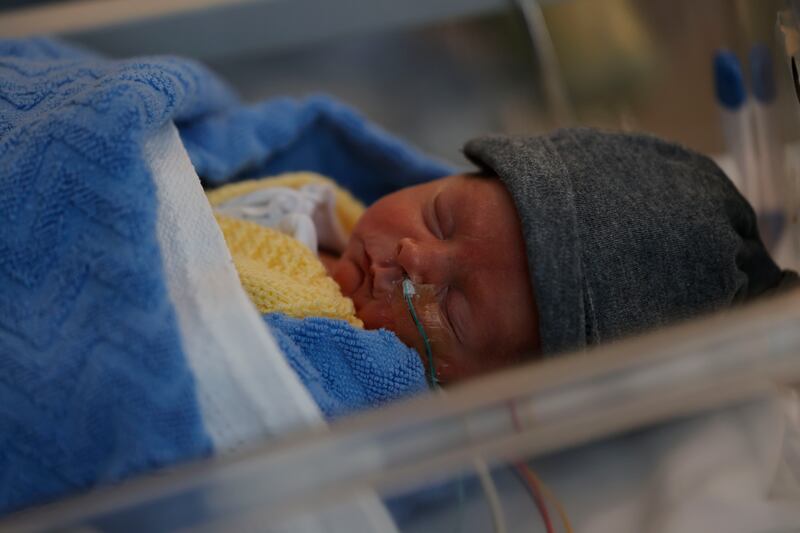 Louis was delivered at St Vincent's Hospital, weighing 2.01kg (4lb 7oz). He was stabilised and then brought the 4km to the neonatal intensive care unit in Holles Street. Photograph: Alan Betson 
