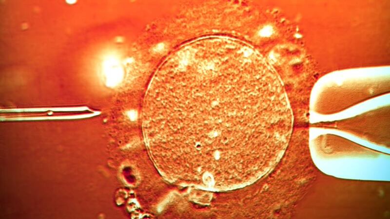IVF: Irish children conceived with anonymous sperm and eggs will never know the full details of their genetic parentage. Photograph: Zephyr/SPL/Getty