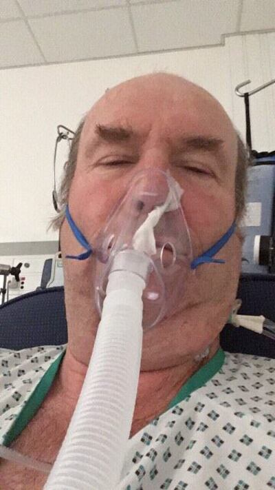 John had to wear this mask for the first couple of days after waking from the 12-hour operation. He had been asleep for 16 hours.