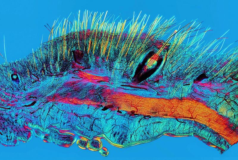 Cat skin and blood supply - This sample from a Victorian microscope slide shows a section of cat skin, with hairs, whiskers and their blood supply visible. Whiskers are important touch receptors used by cats to detect the vibrations of nearby moving objects. They are also the same width as a cats body, and tell them whether they can squeeze into narrow spaces. Image: David Linstead. Wellcome Images