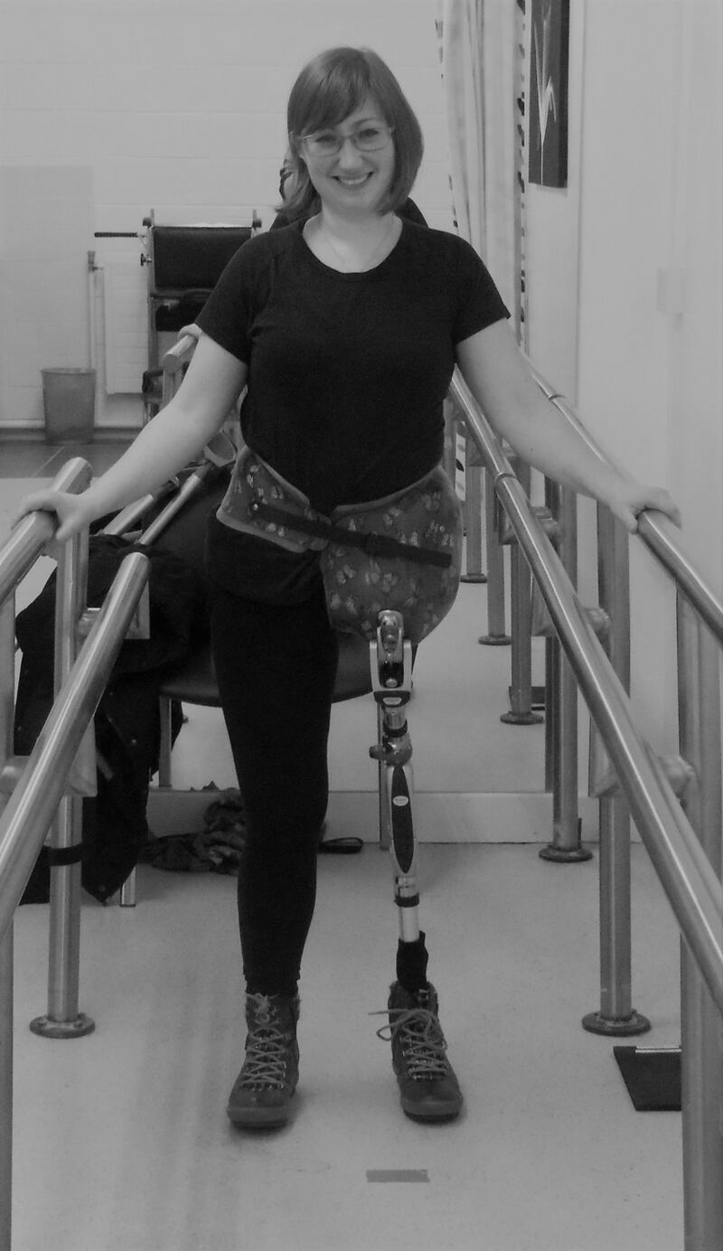 Tanya and her prosthetic leg