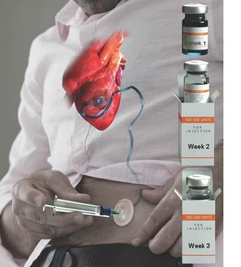 A visualisation of how ‘Therepi’ would be used in a clinical setting. Photograph: Peter Allen/Harvard John A Paulson School of Engineering and Applied Sciences