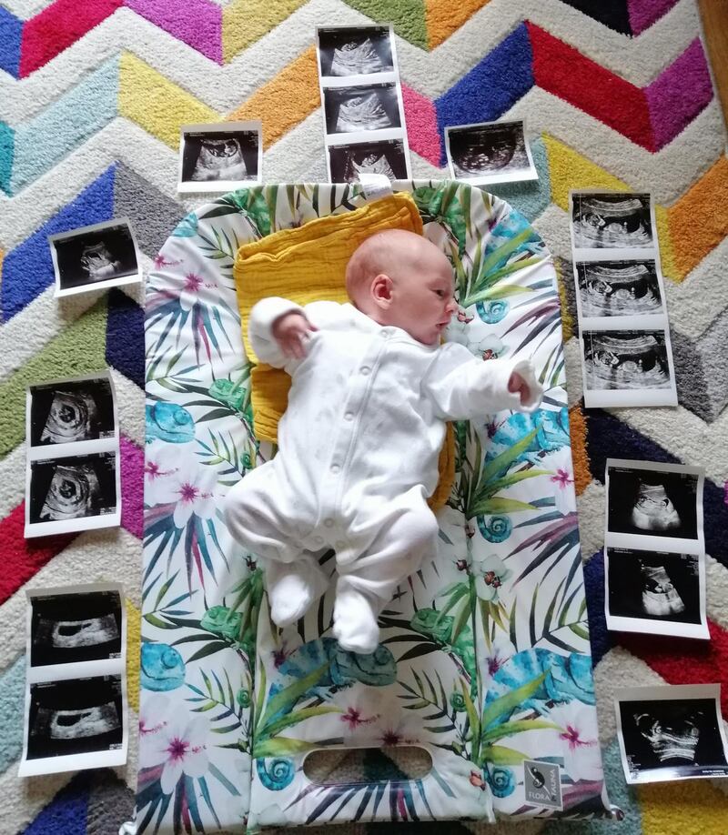 Emma Byrne’s baby Aonghus was monitored regularly before he was born in October, as Byrne had lost five pregnancies.