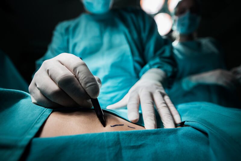 Significant risks are associated with cosmetic surgery. Photograph: iStock