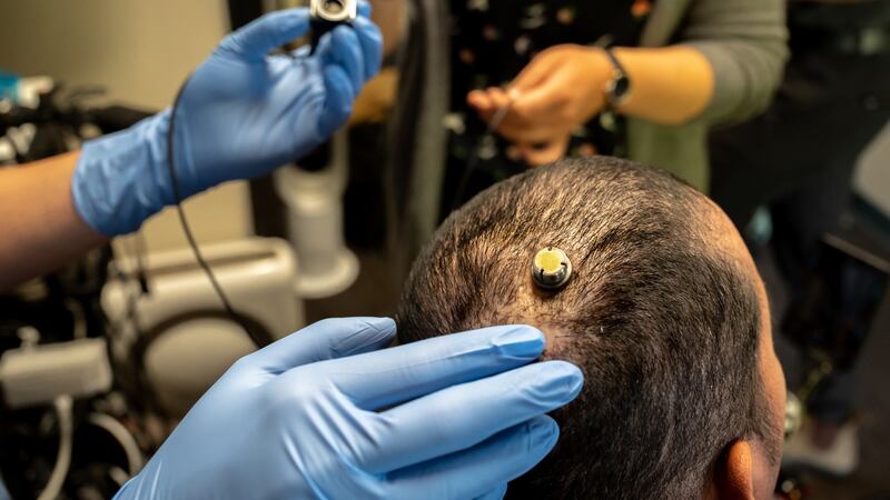 Dr Eddie Chang prepares to connect Pancho’s brain implant to a computer, which uses a form of artificial intelligence to recognize the words he intends to say, in San Francisco on July 5th, 2021. Photograph: Mike Kai Chen/The New York Times