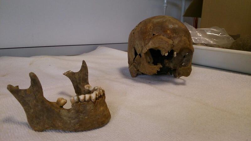 The skull of a victim of the Spanish civil war, at the Association for the Recovery of Historical Memory laboratory in Ponferrada. Photogragh: Guy Hedgecoe