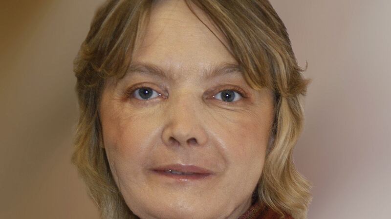 Isabelle Dinoire poses for a portrait one year after becoming the first person in the world undergo a face transplant after she was attacked by dogs. Photograph:   CHU Amiens via Getty Images