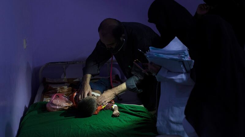 A young boy suffering from malnutrition examined at a hospital in Hajjah, Yemen. Photograph: Tyler Hicks/The New York Times
