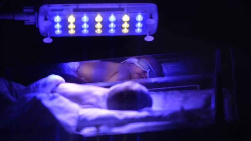 A  premature baby in the Neonatal intensive care unit at the National Maternity Hospital Holles St. Photograph: Alan Betson