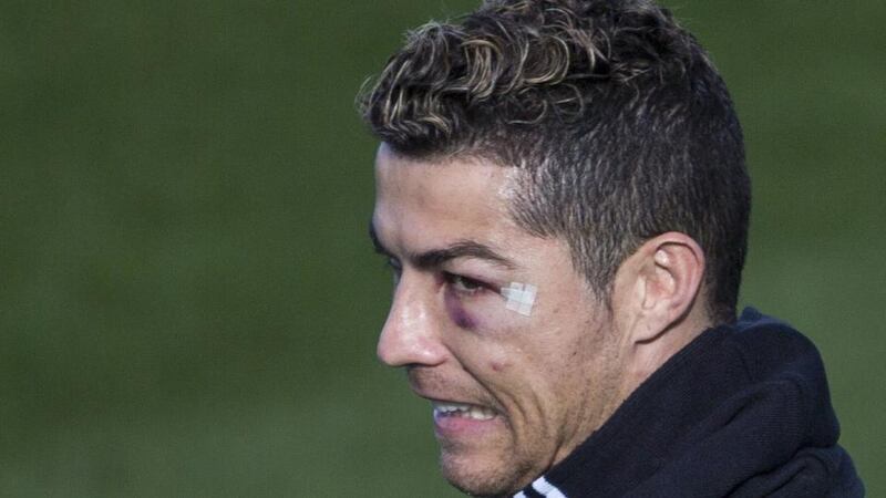 Cristiano Ronaldo sports a black eye during Real Madrid’s training session   at Valdebebas sports city in Madrid on Tuesday morning. Photograph: Rodrigo Jimenez/EPA